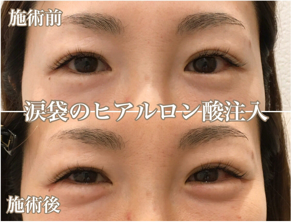 No.1091の症例写真 No.1091の症例写真