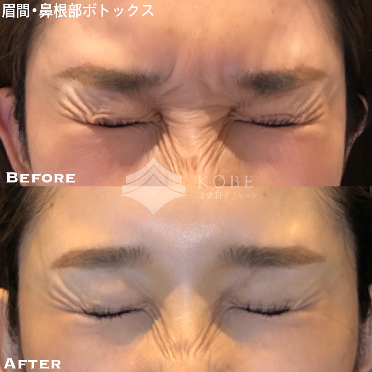 No.211の症例写真 No.211の症例写真