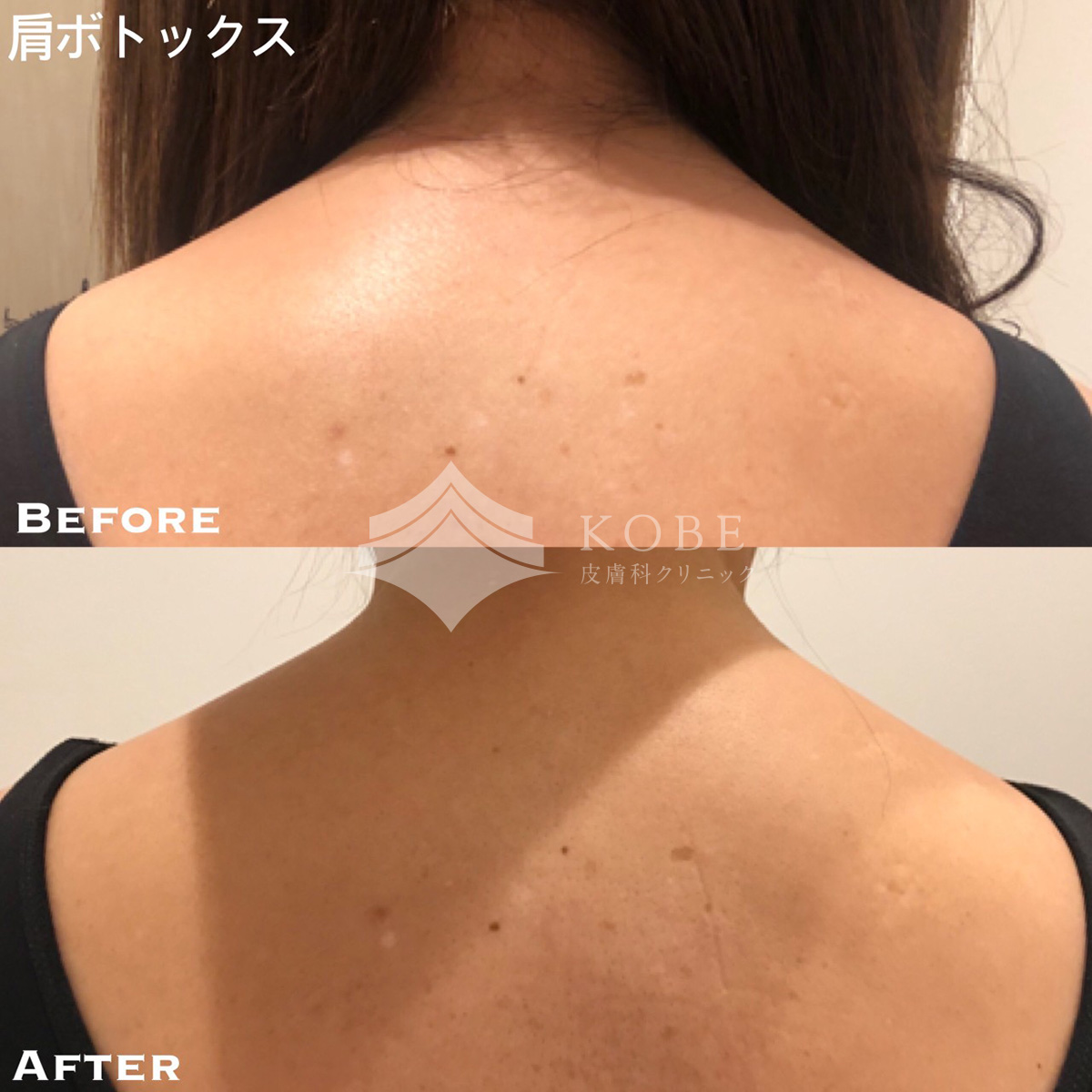 No.661の症例写真 No.661の症例写真