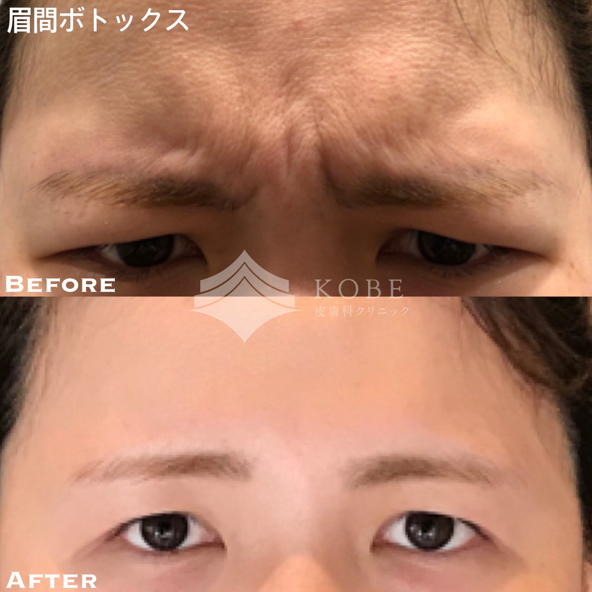 No.701の症例写真 No.701の症例写真