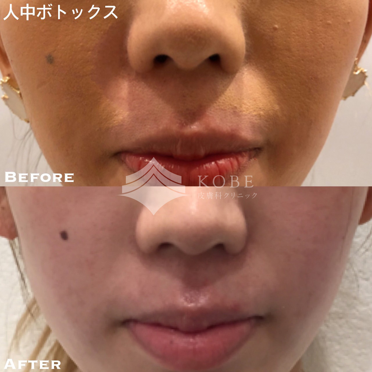 No.708の症例写真 No.708の症例写真