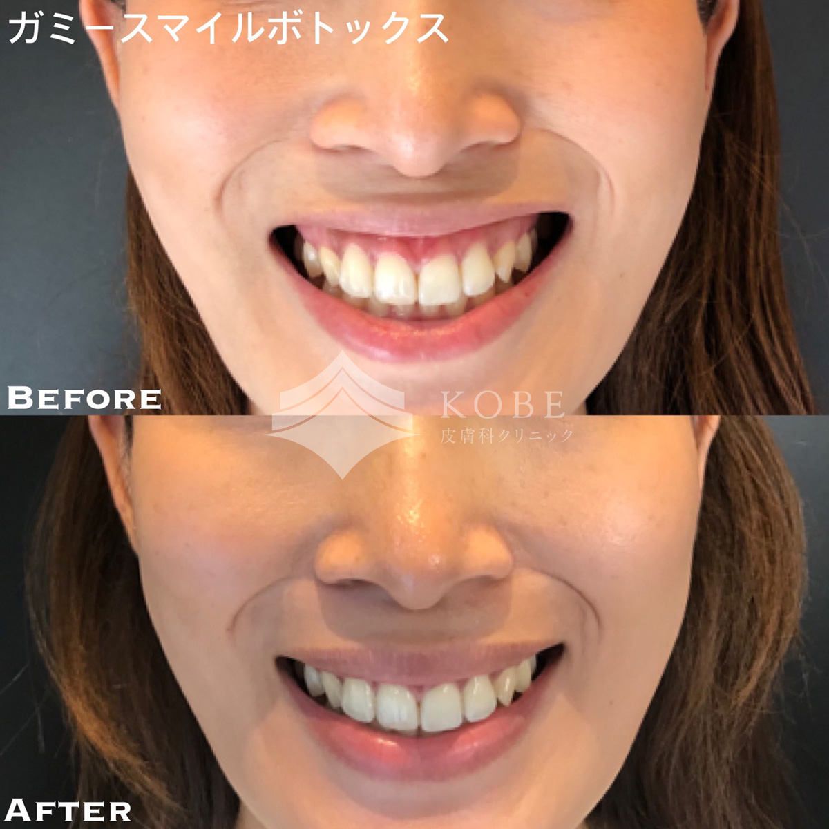 No.716の症例写真 No.716の症例写真
