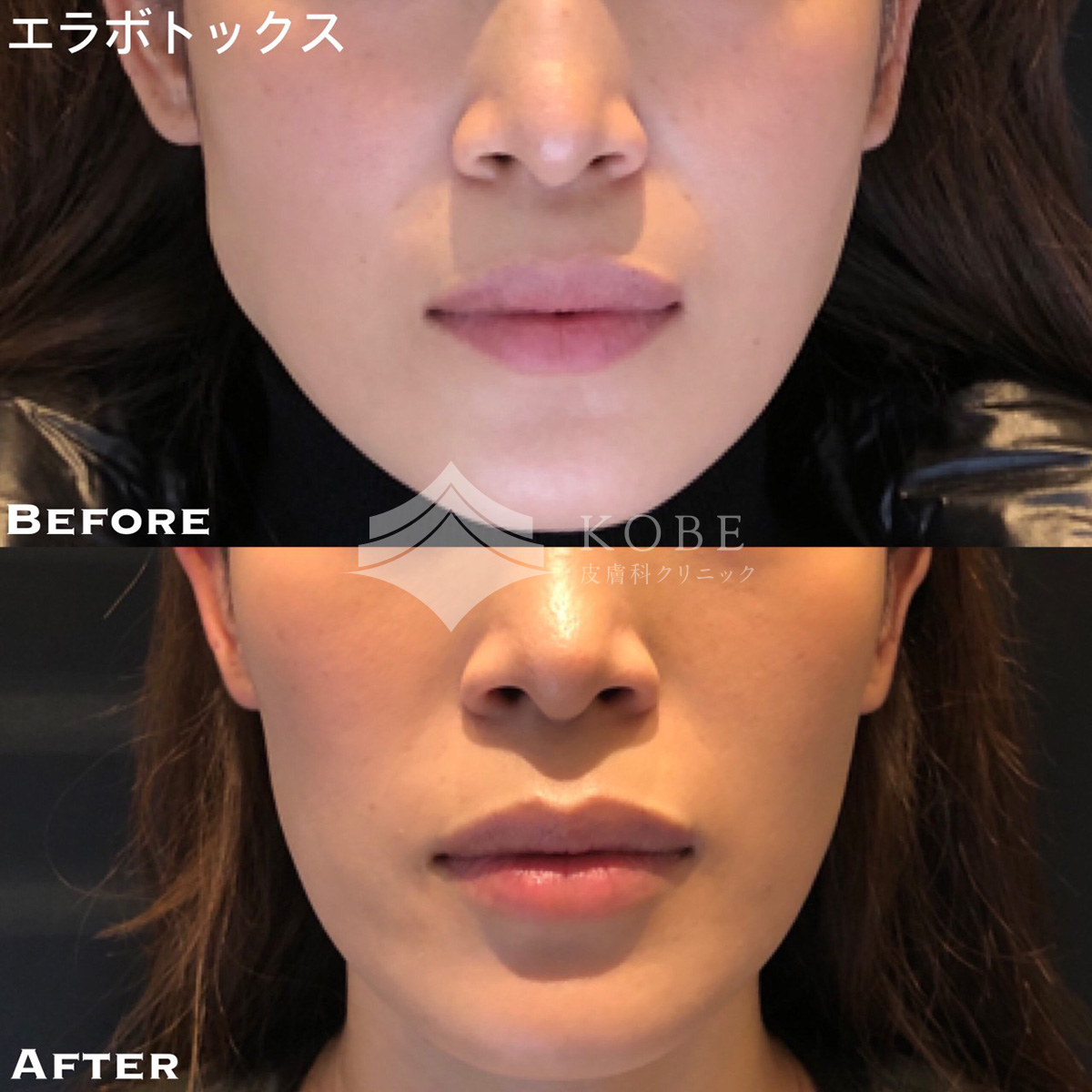 No.720の症例写真 No.720の症例写真