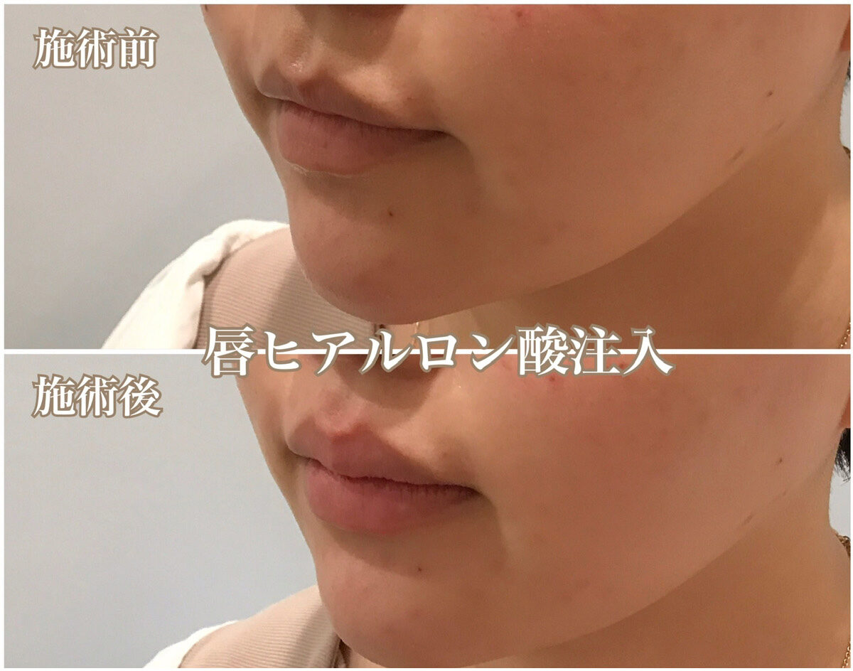 No.1106の症例写真 No.1106の症例写真