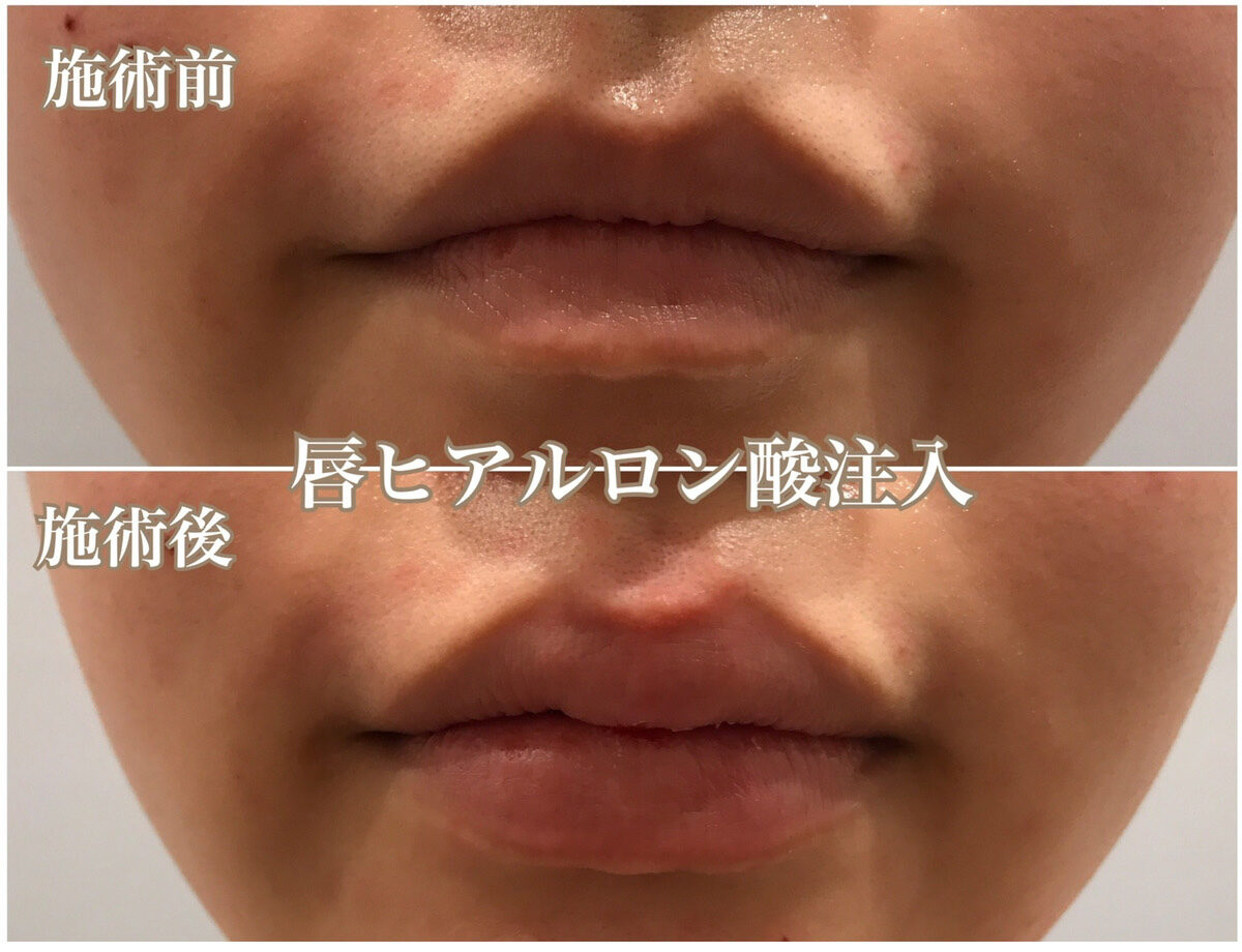 No.1111の症例写真 No.1111の症例写真