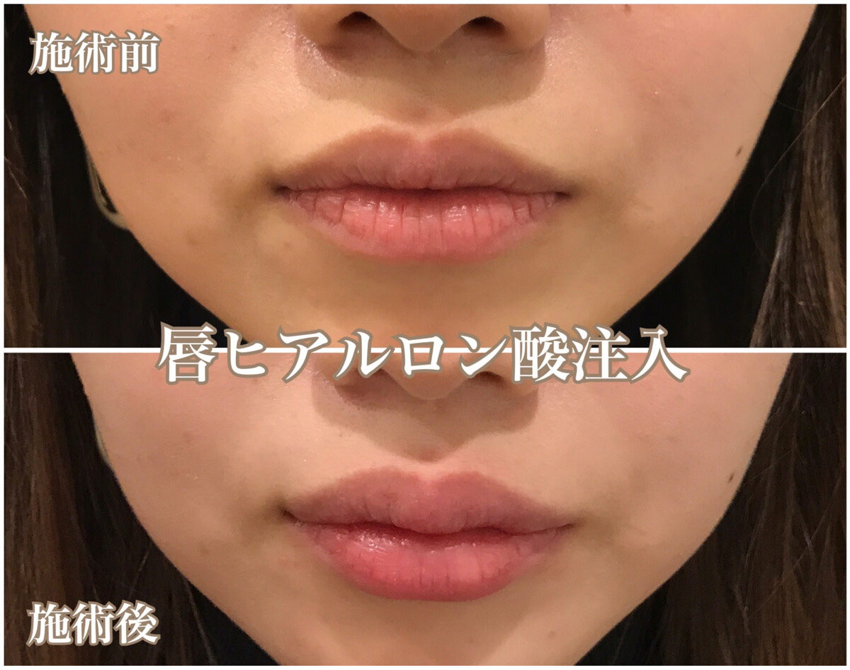 No.1116の症例写真 No.1116の症例写真