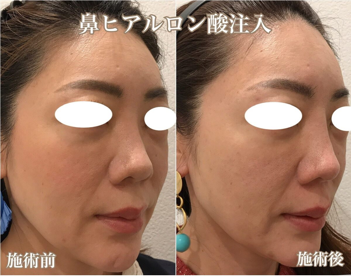 No.1127の症例写真 No.1127の症例写真