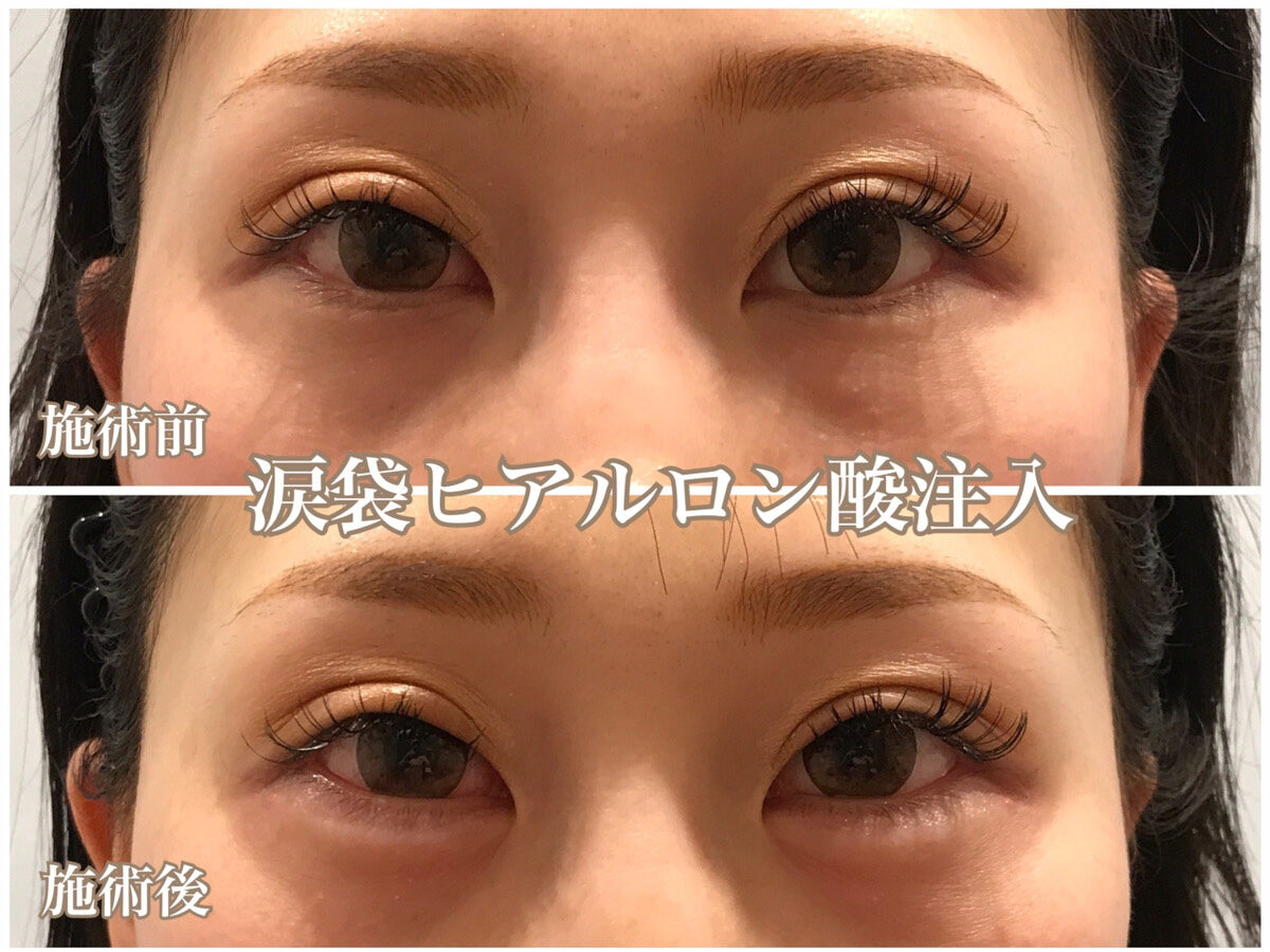 No.1134の症例写真 No.1134の症例写真