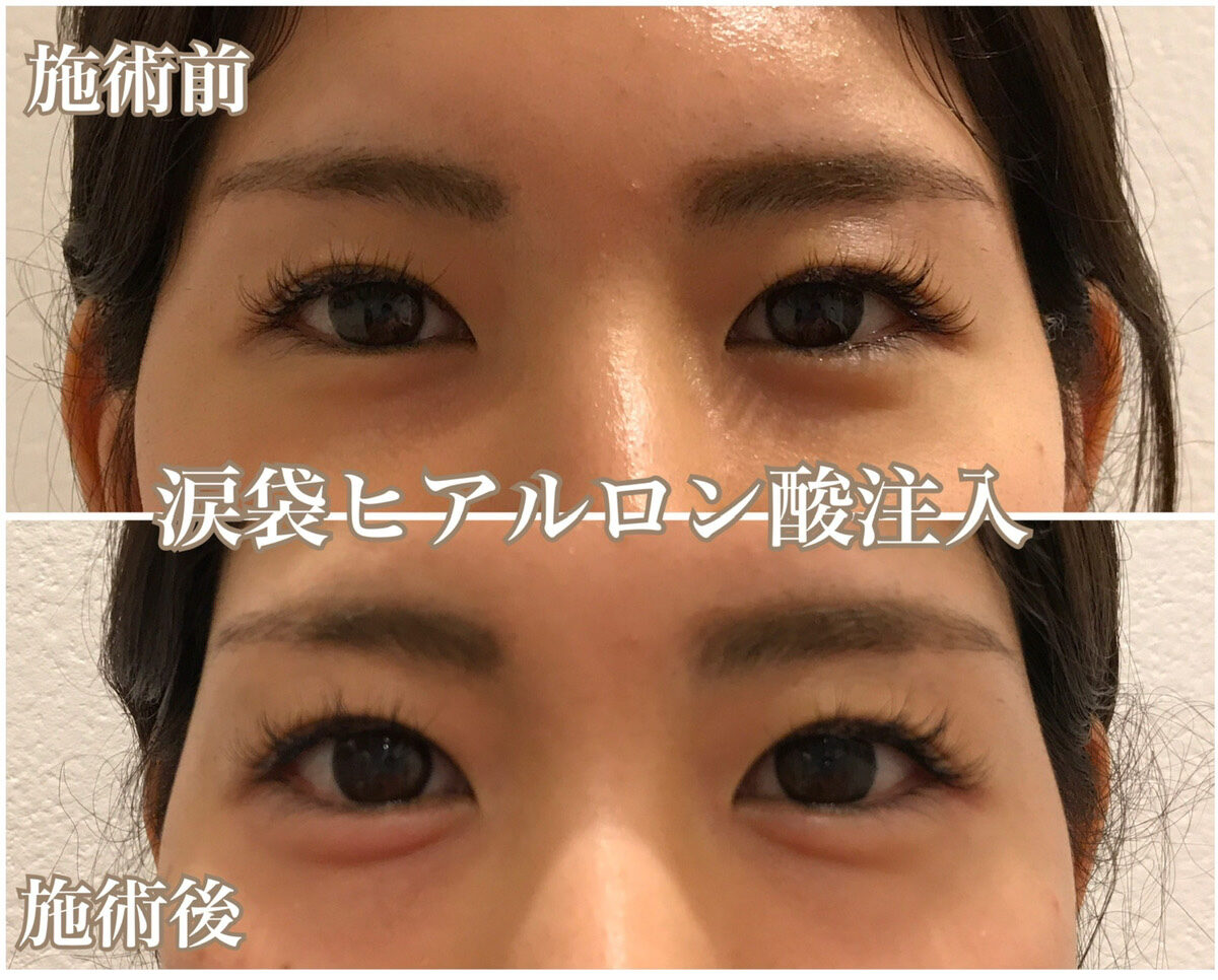 No.1142の症例写真 No.1142の症例写真