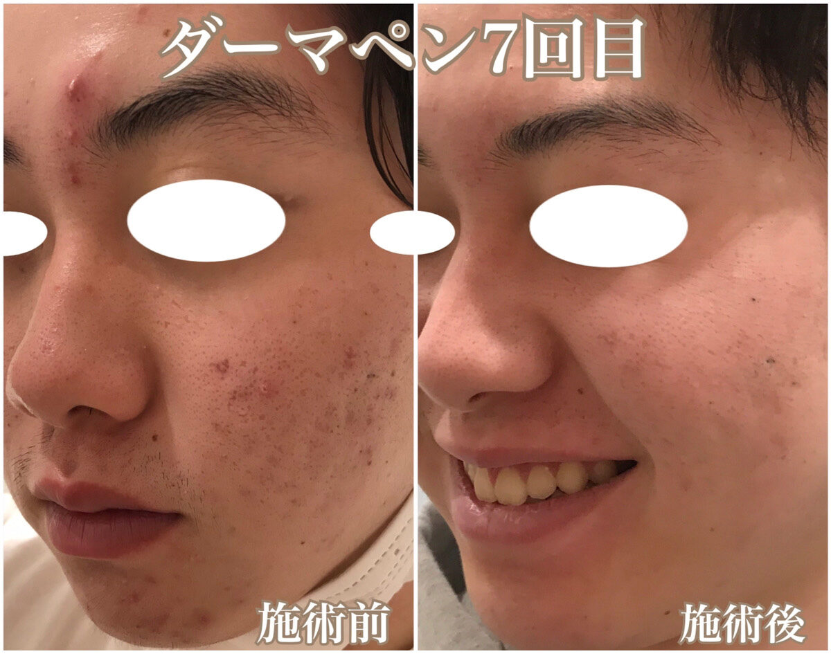 No.1195の症例写真 No.1195の症例写真