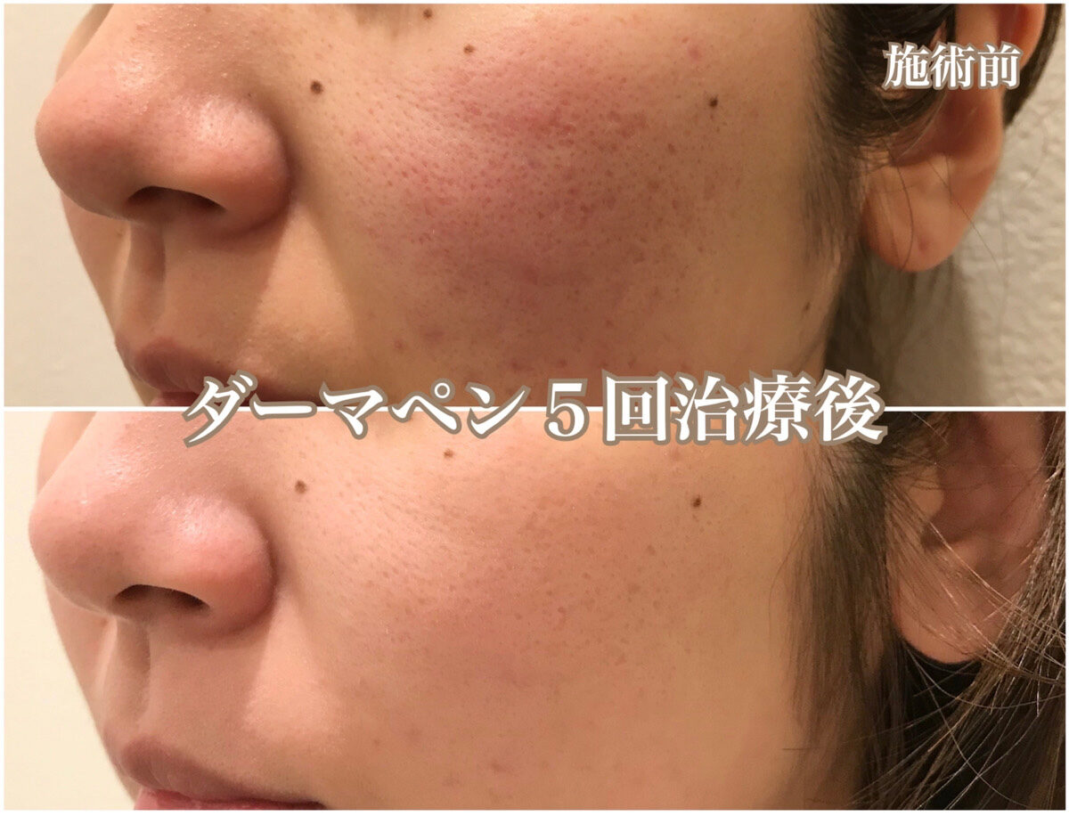 No.1205の症例写真 No.1205の症例写真