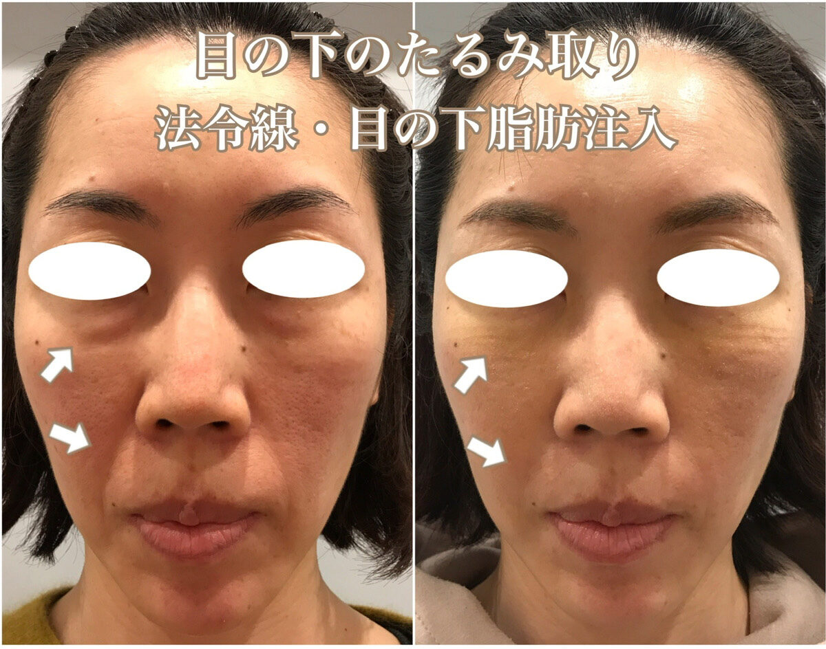 No.1210の症例写真 No.1210の症例写真