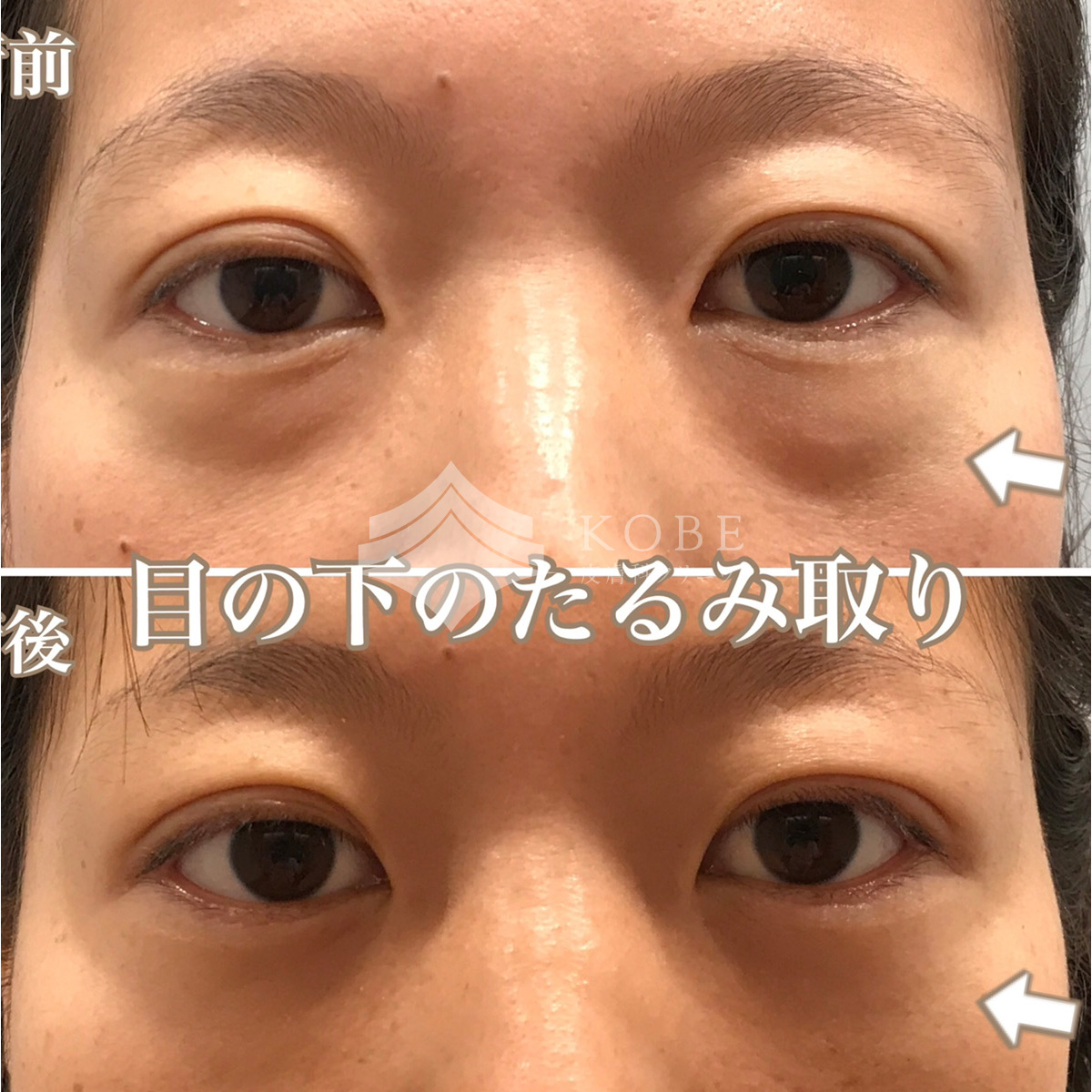 No.1214の症例写真 No.1214の症例写真