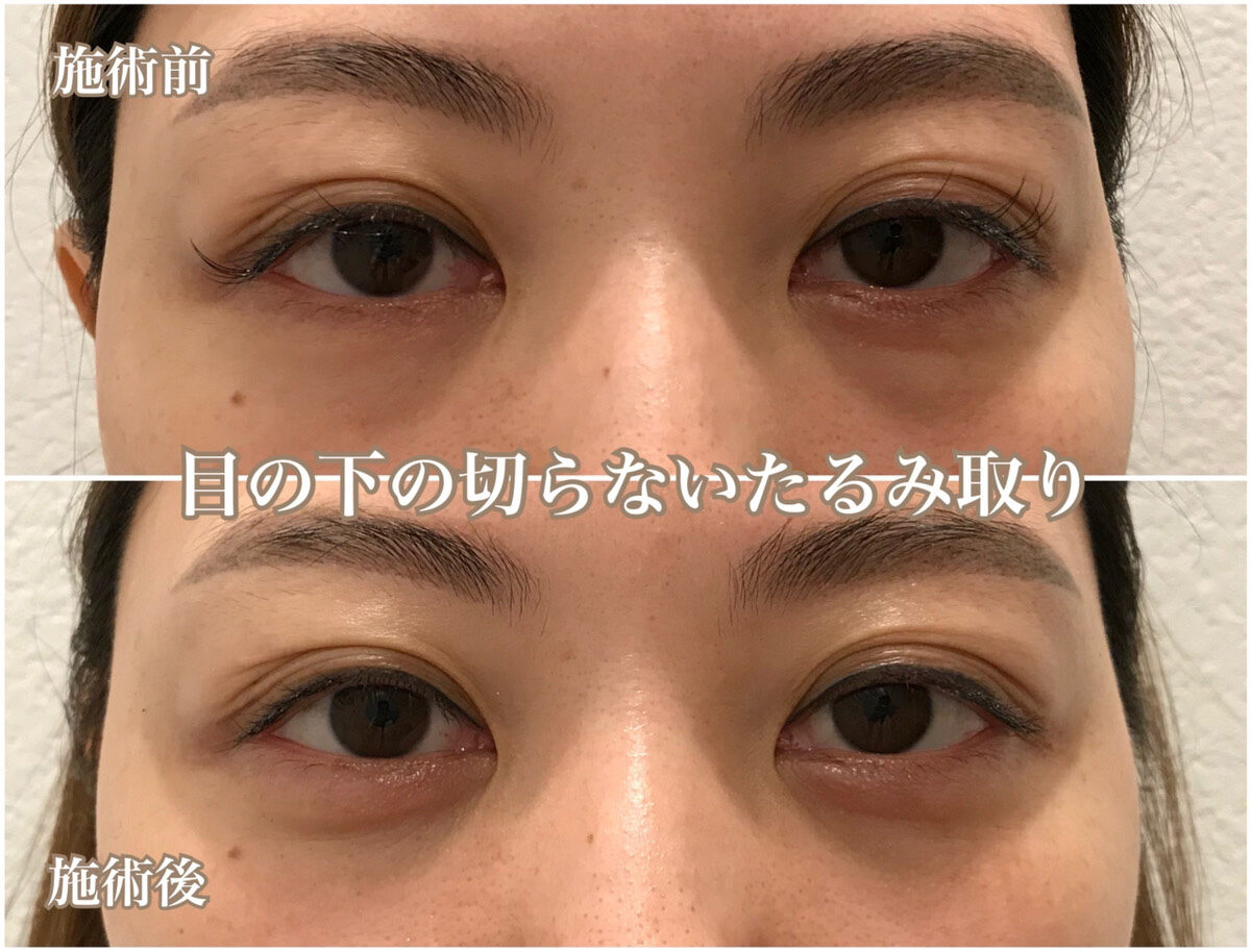 No.1219の症例写真 No.1219の症例写真