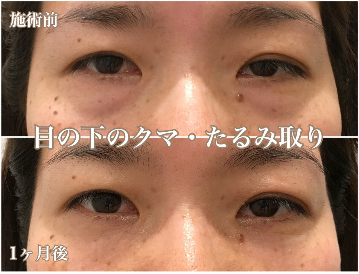 No.1250の症例写真 No.1250の症例写真