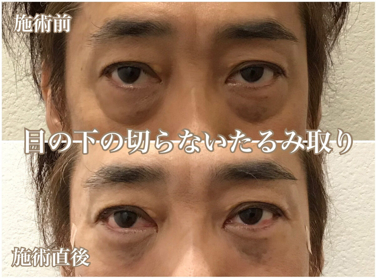 No.1270の症例写真 No.1270の症例写真
