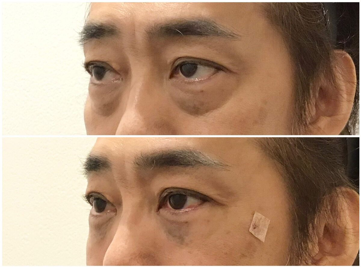 No.1282の症例写真 No.1282の症例写真