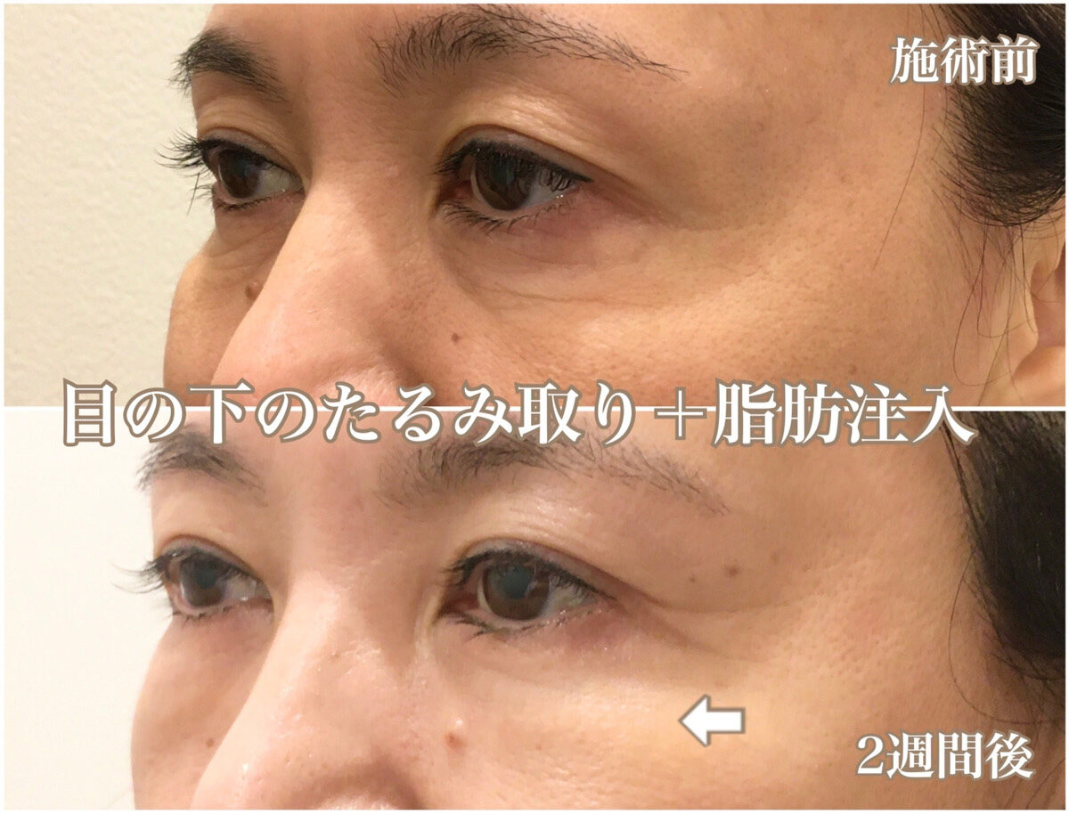 No.1298の症例写真 No.1298の症例写真