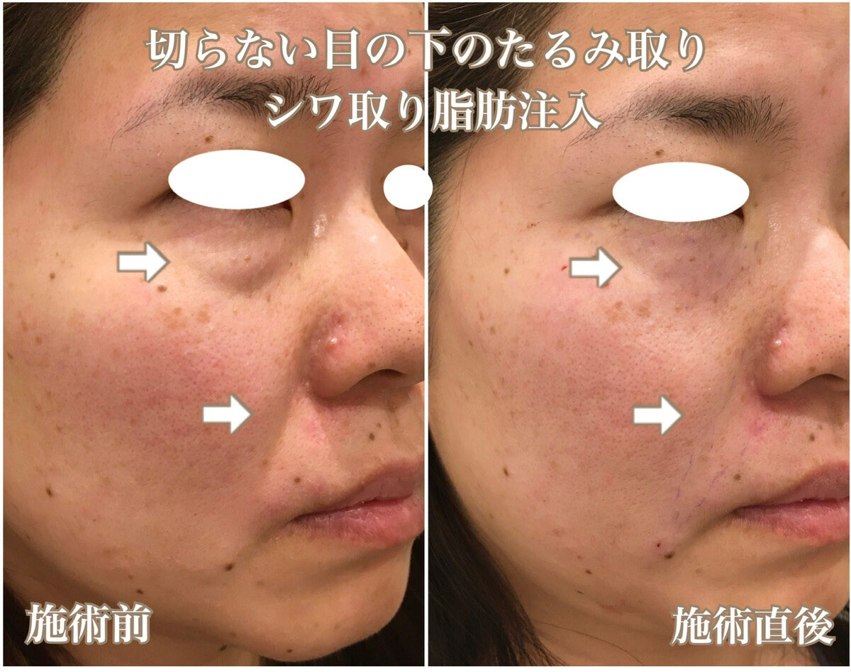No.1303の症例写真 No.1303の症例写真