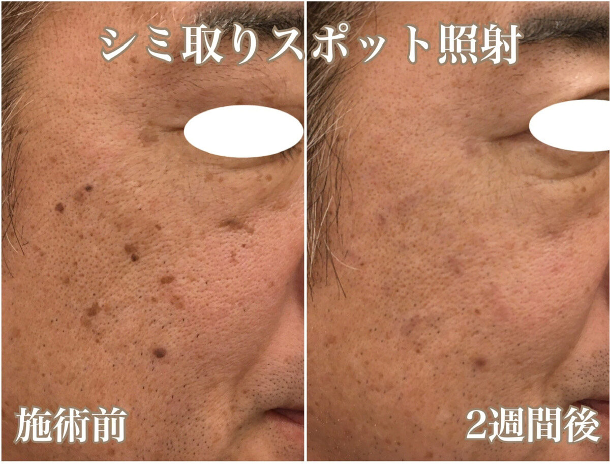 No.1305の症例写真 No.1305の症例写真