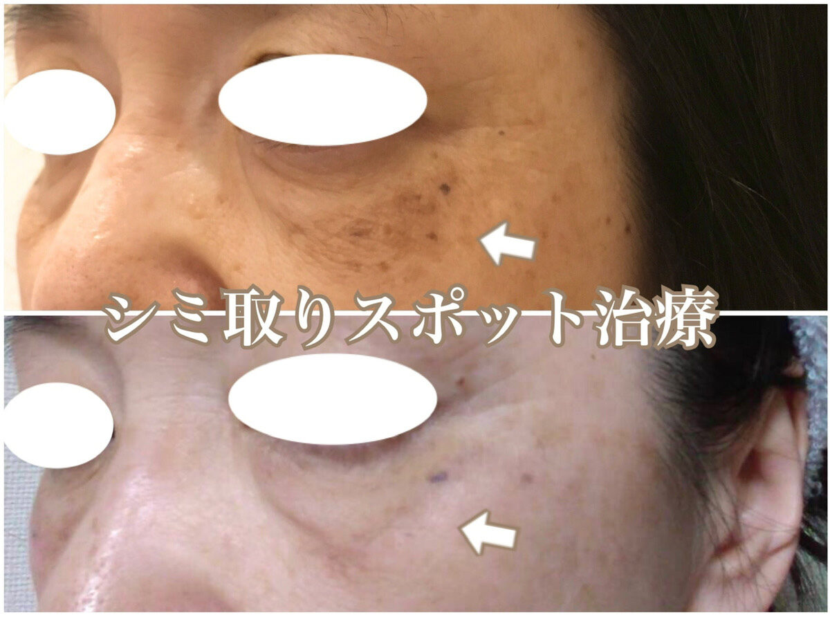 No.1317の症例写真 No.1317の症例写真