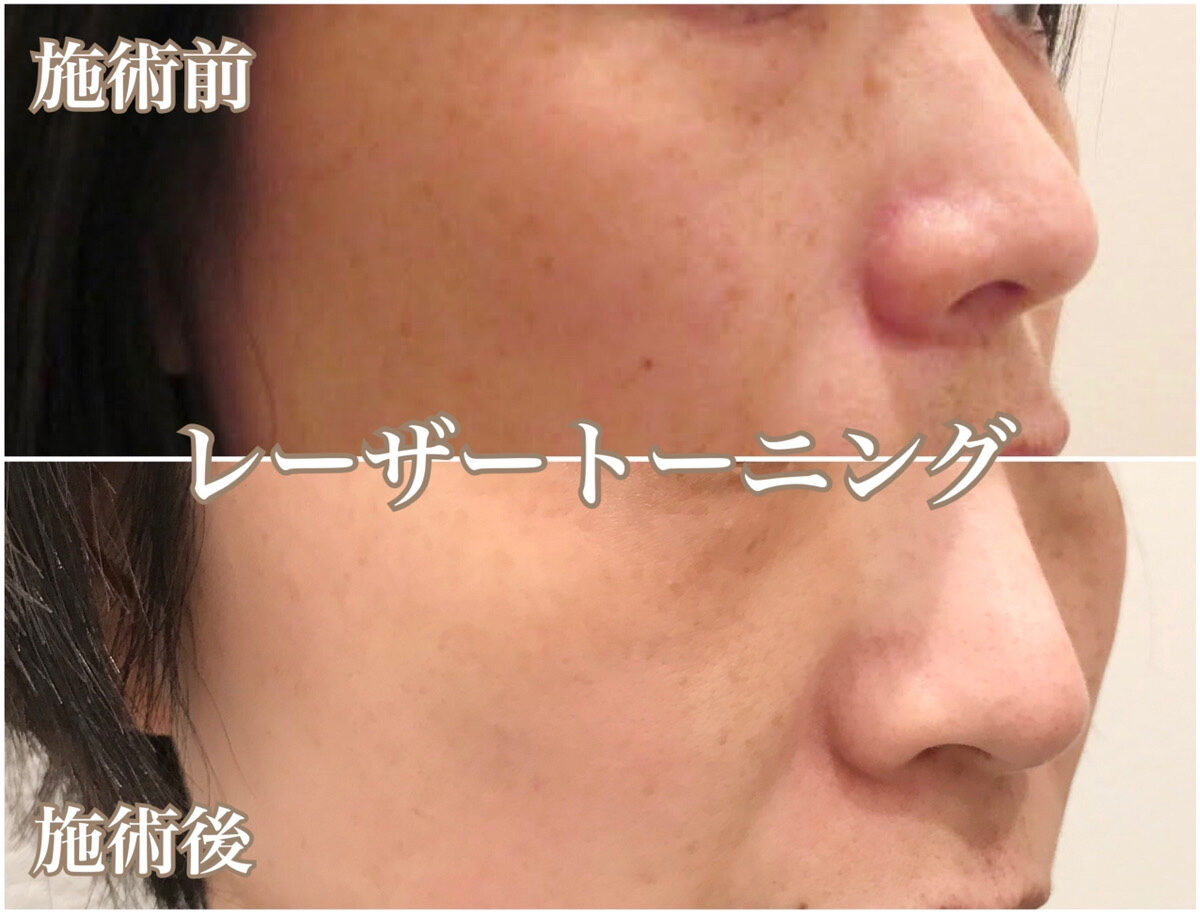 No.1327の症例写真 No.1327の症例写真