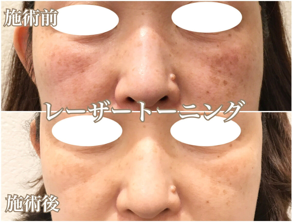 No.1336の症例写真 No.1336の症例写真