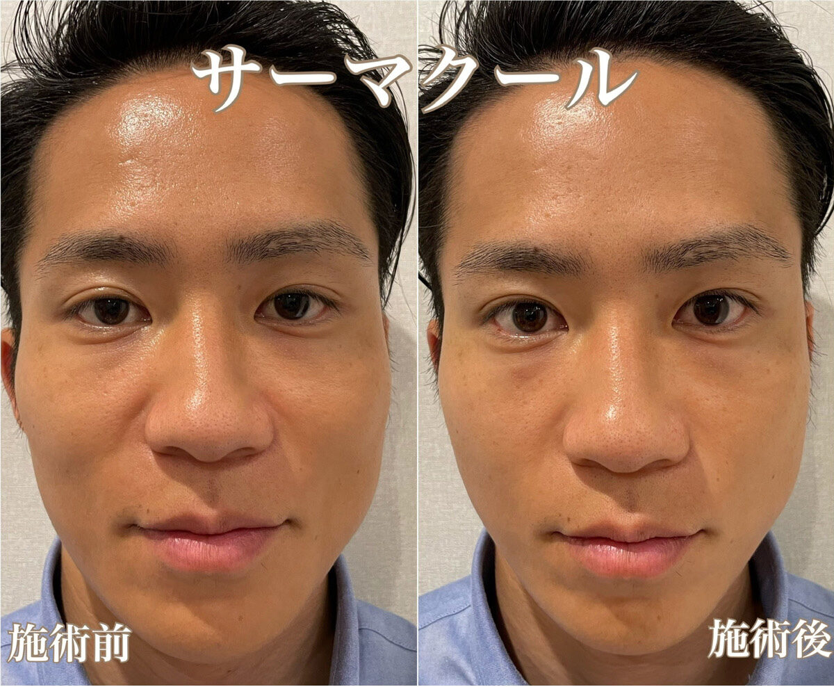 No.1340の症例写真 No.1340の症例写真
