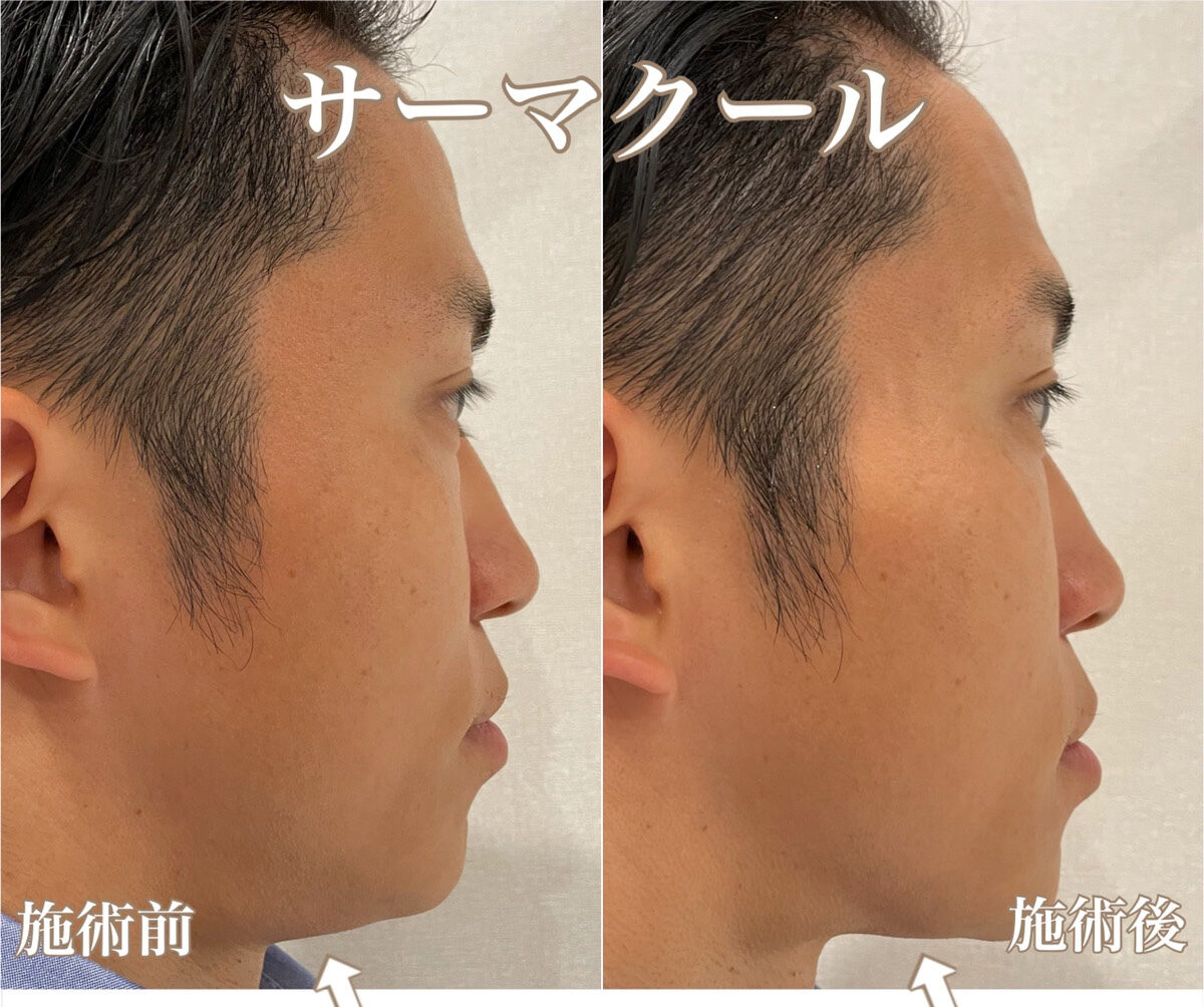 No.1349の症例写真 No.1349の症例写真