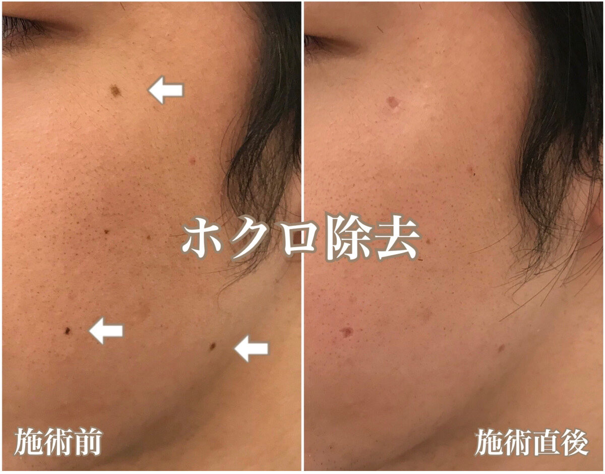No.1358の症例写真 No.1358の症例写真