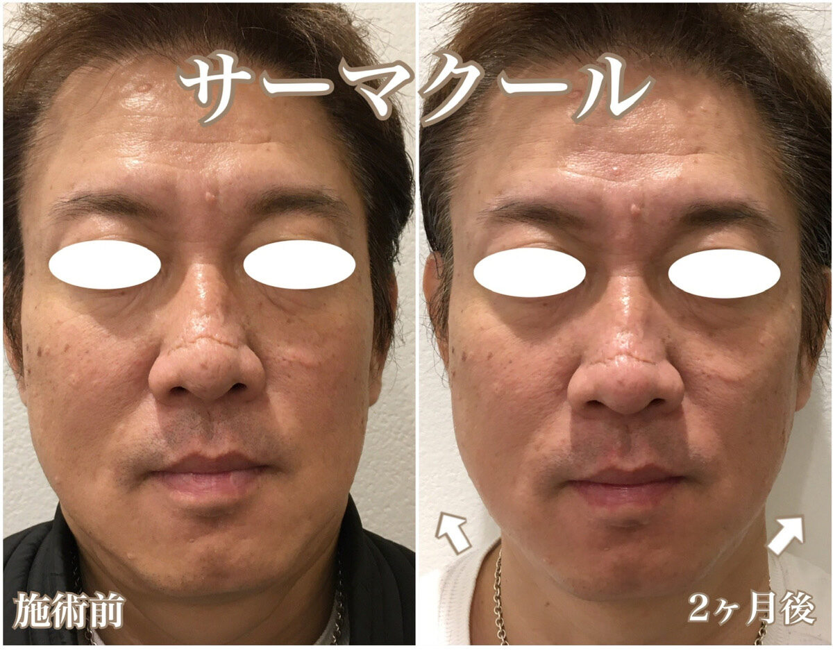 No.1362の症例写真 No.1362の症例写真