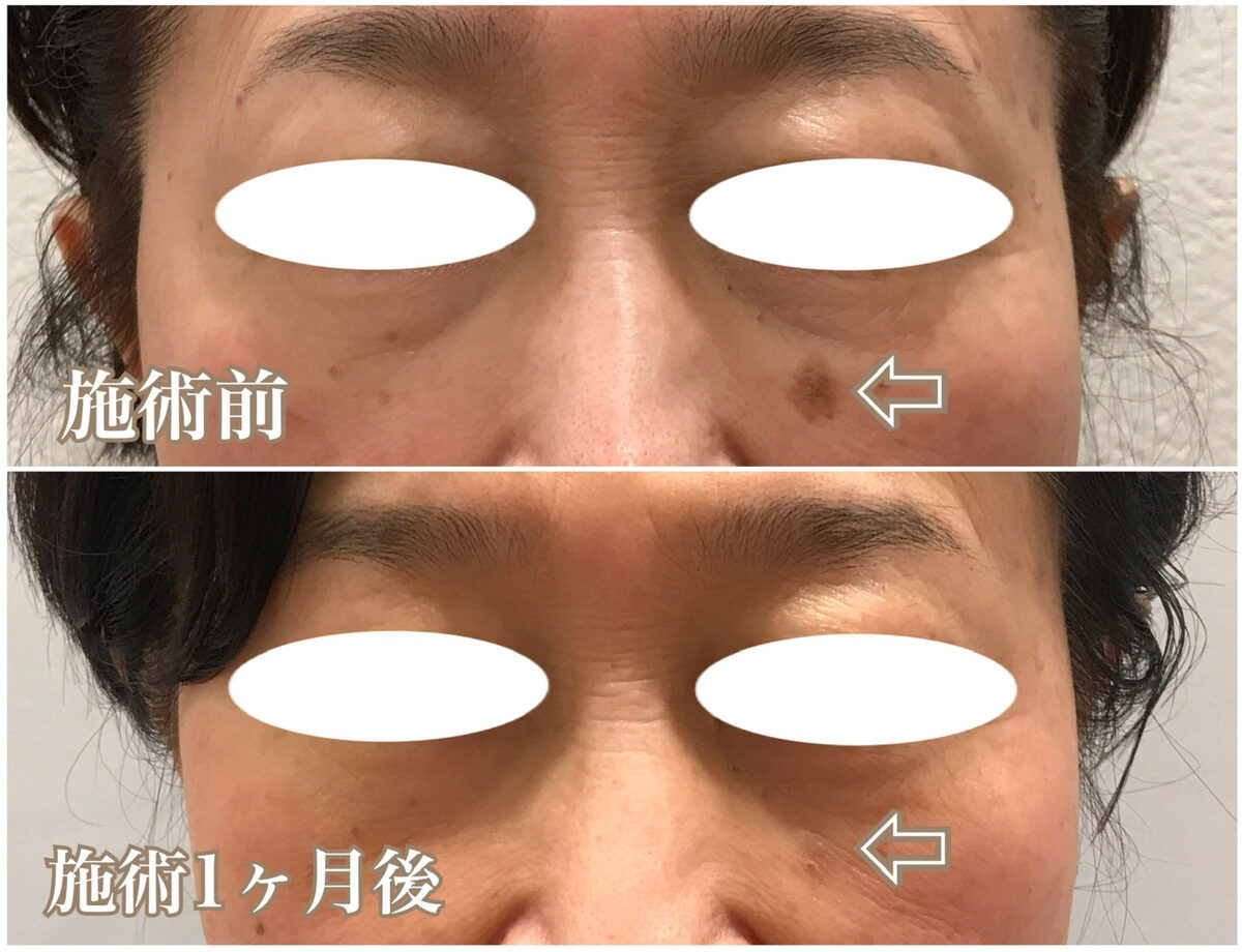 No.1371の症例写真 No.1371の症例写真