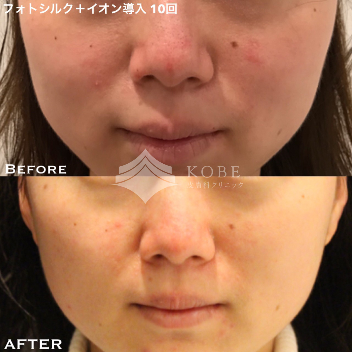 No.1401の症例写真 No.1401の症例写真