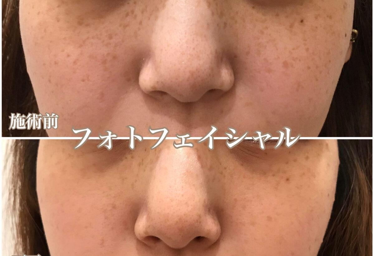 No.1421の症例写真
