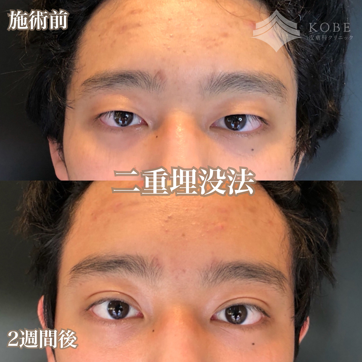 No.1426の症例写真 No.1426の症例写真