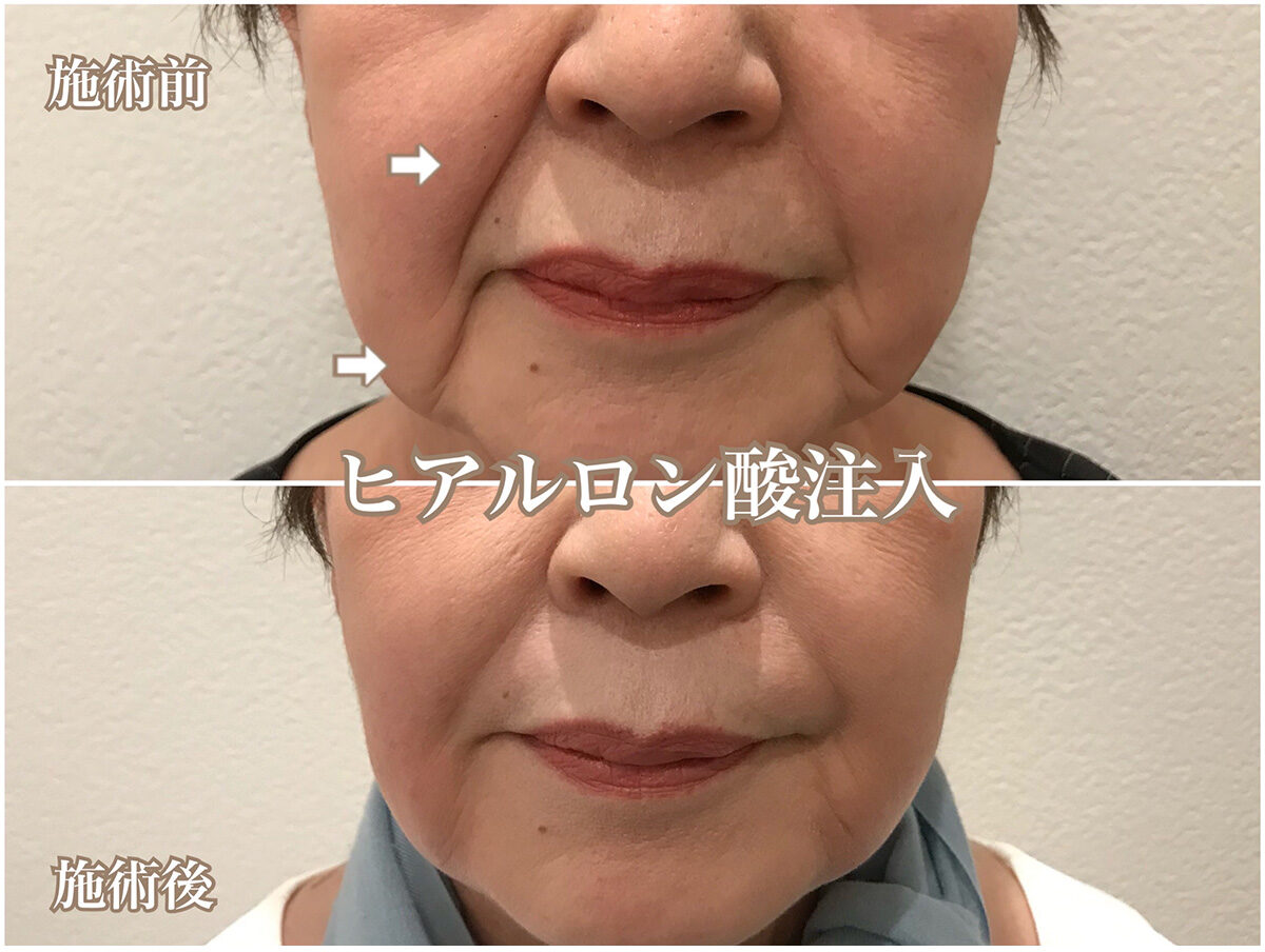 No.1456の症例写真