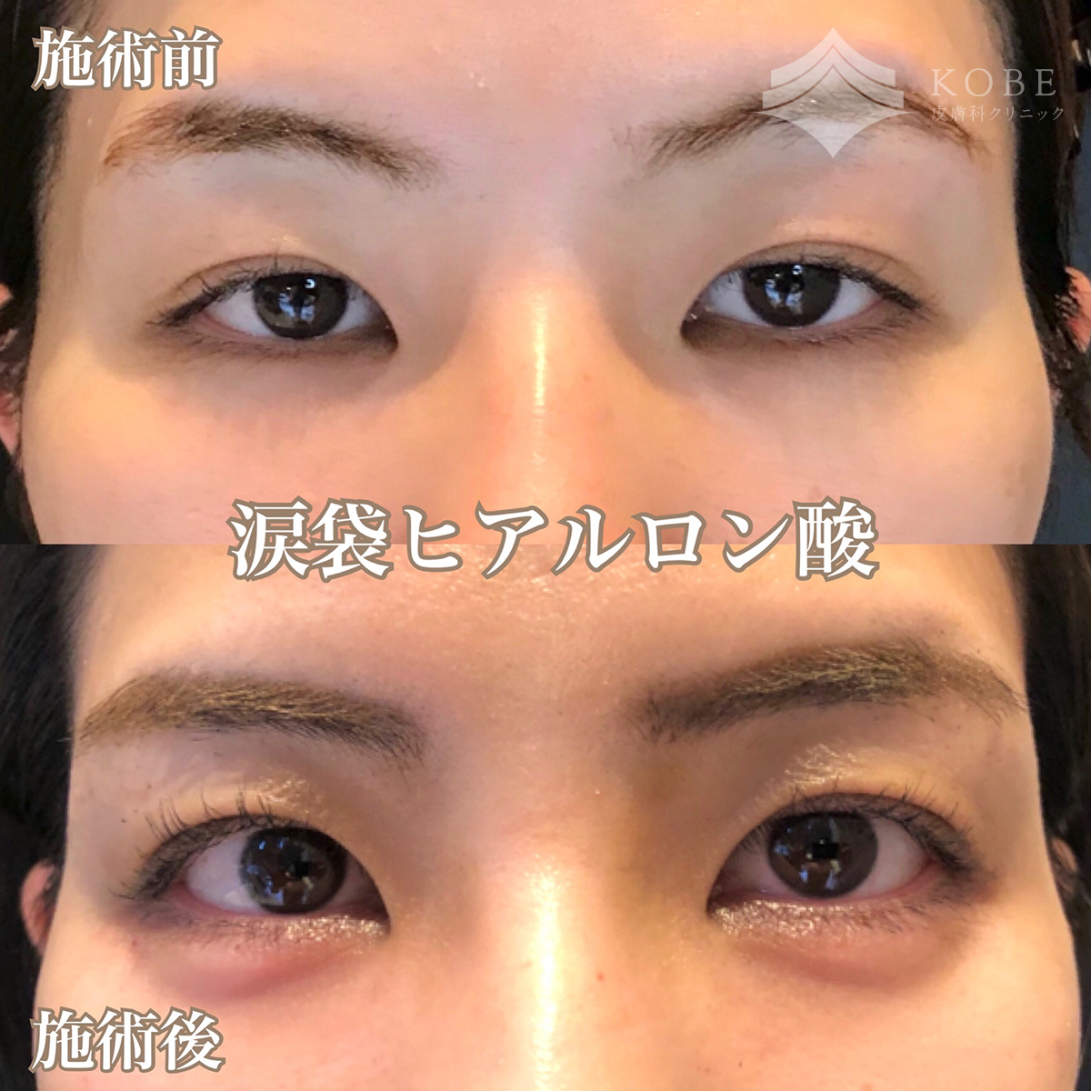 No.1498の症例写真