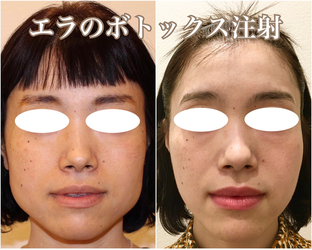 No.1502の症例写真 No.1502の症例写真