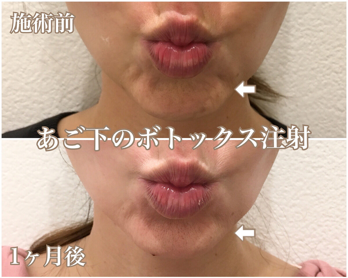 No.1506の症例写真