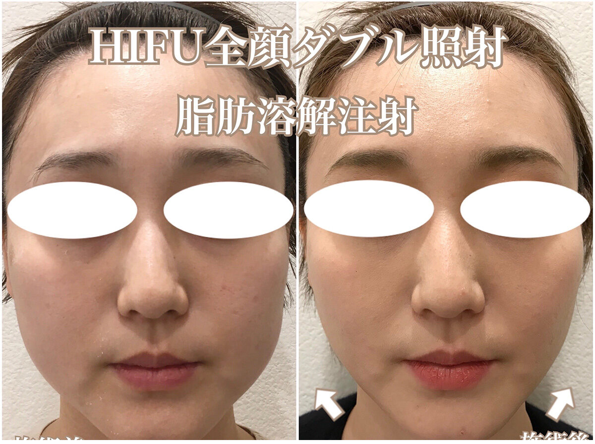 No.1519の症例写真 No.1519の症例写真