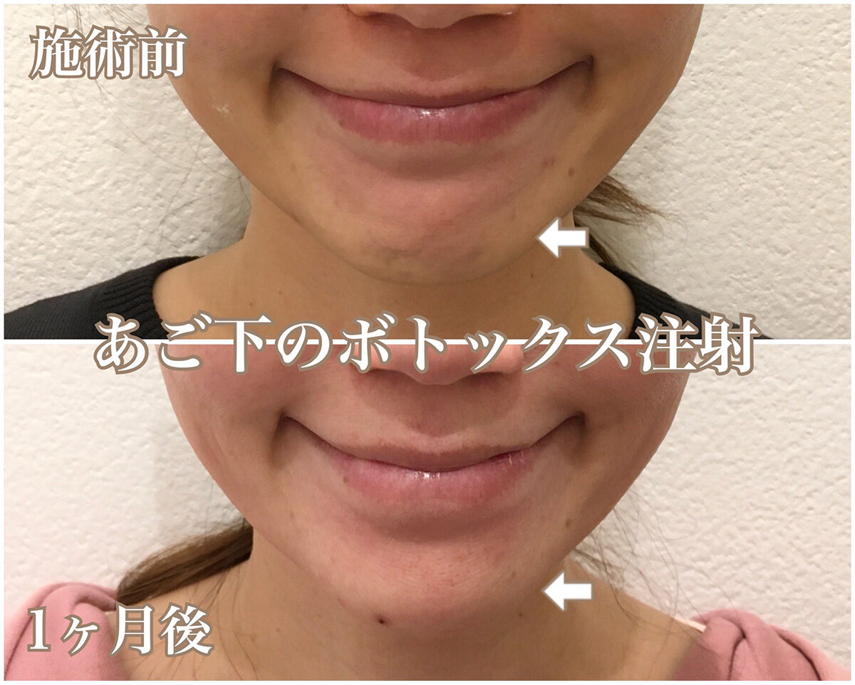 No.1528の症例写真 No.1528の症例写真