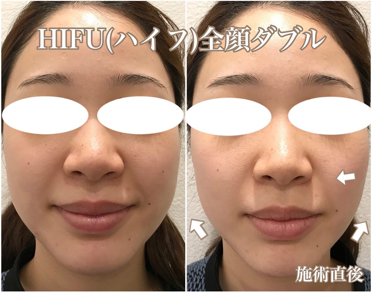 No.1530の症例写真 No.1530の症例写真