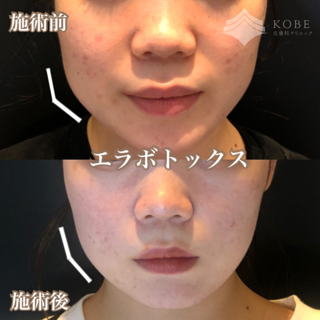 ビフォーアフター