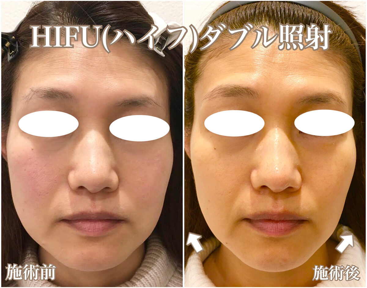 No.1563の症例写真