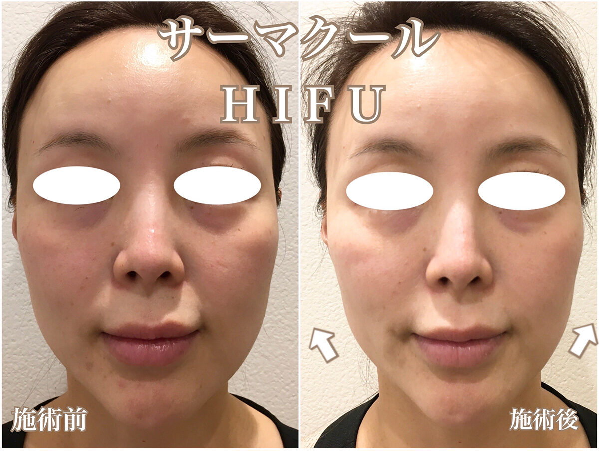 No.1568の症例写真 No.1568の症例写真