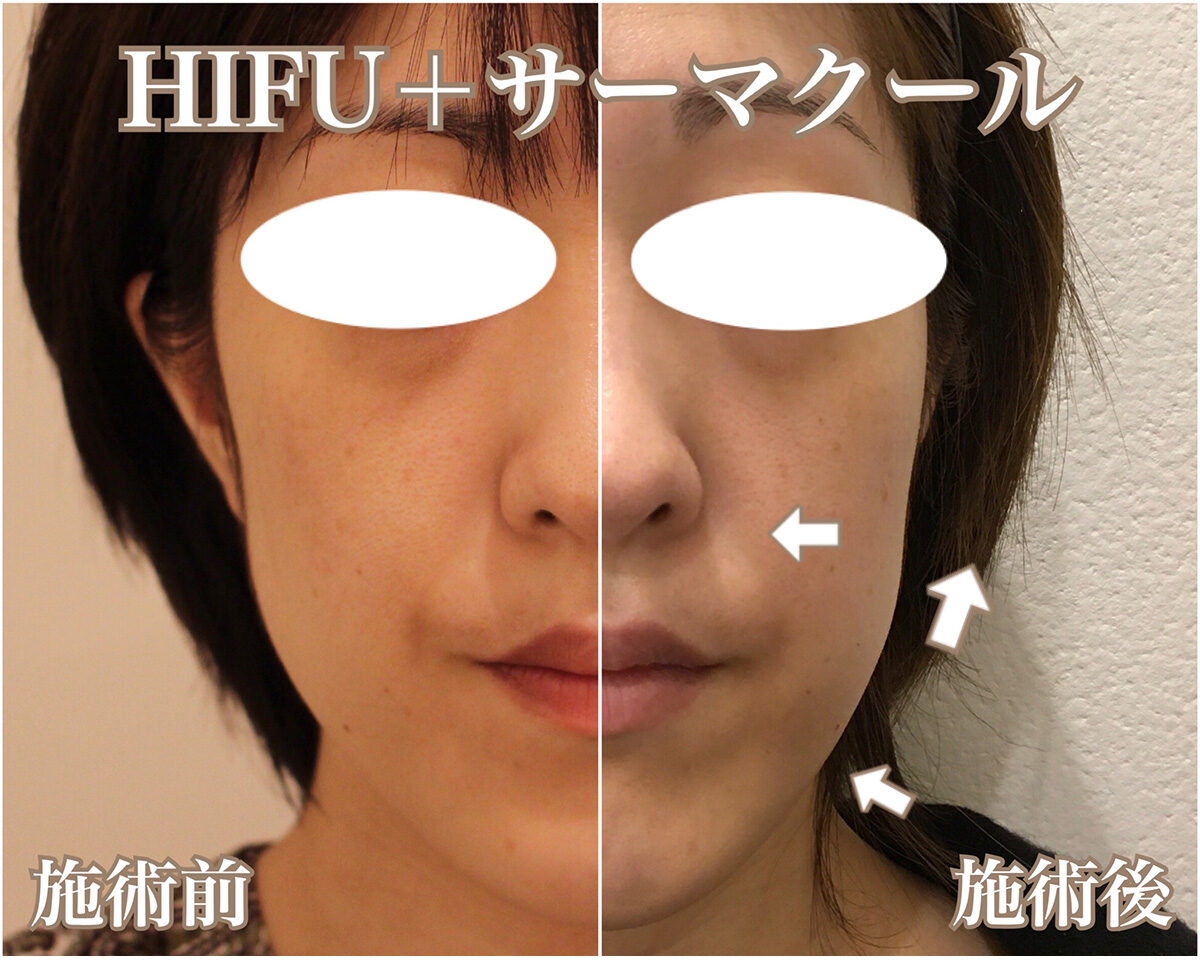 No.1574の症例写真 No.1574の症例写真