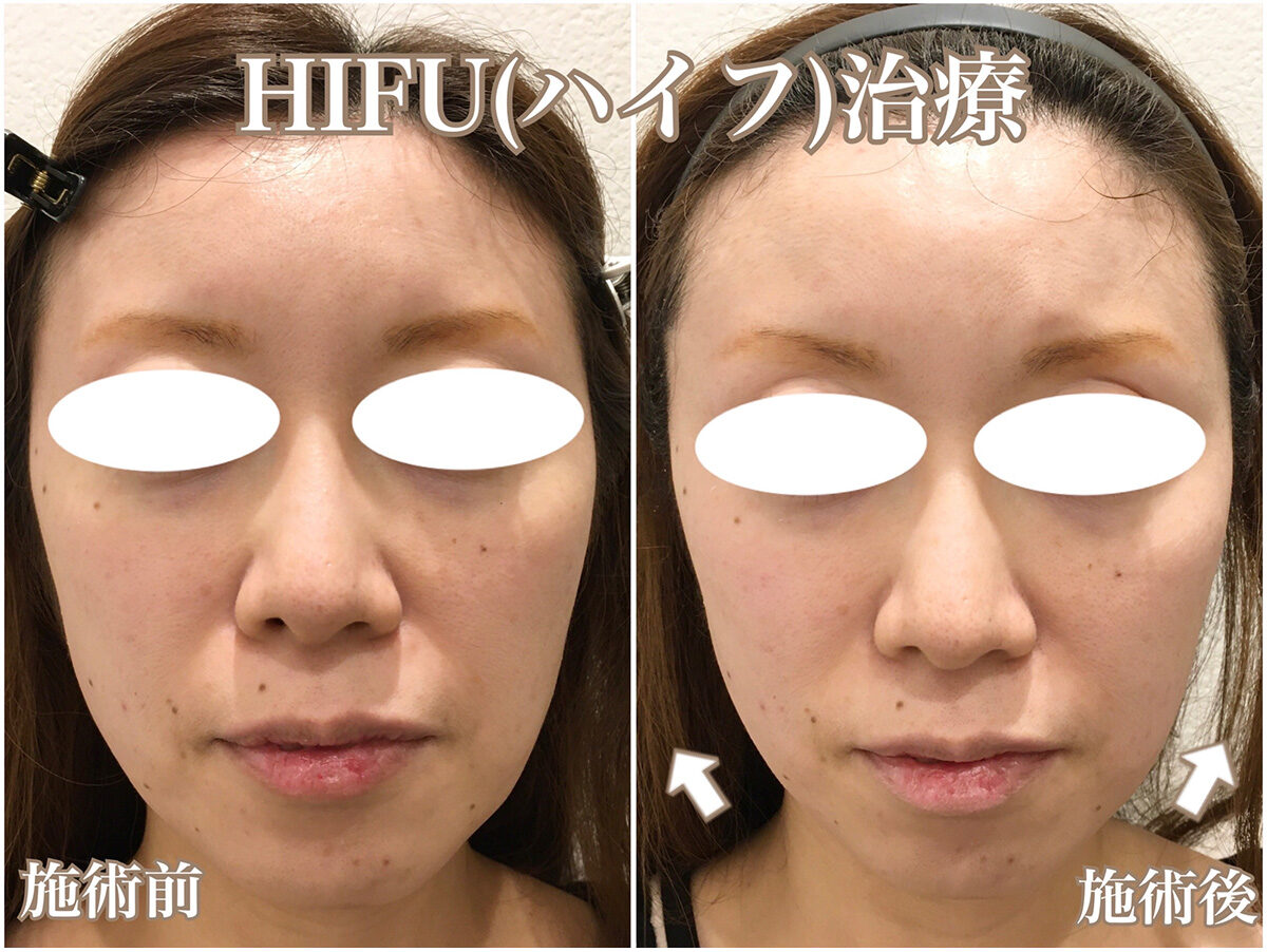 No.1579の症例写真