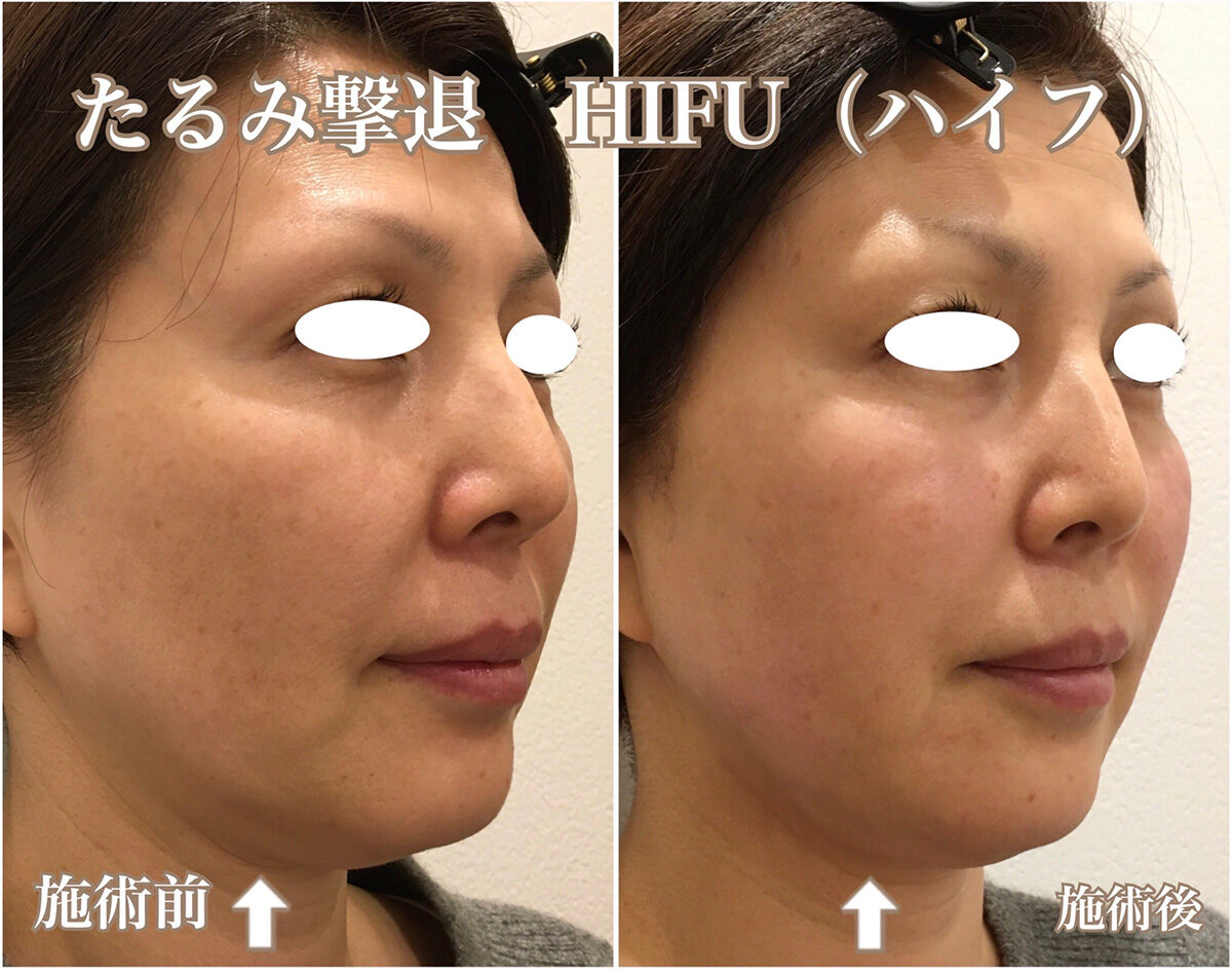 No.1584の症例写真 No.1584の症例写真