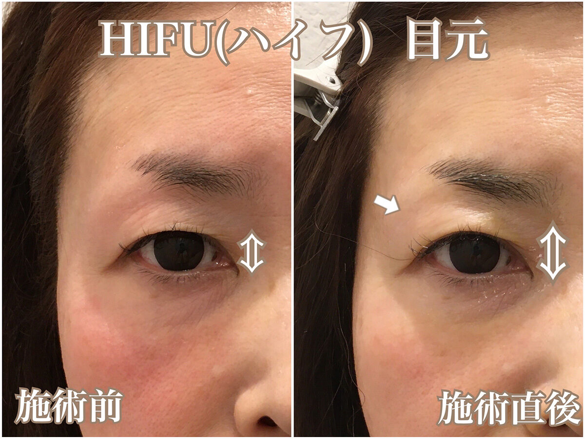 No.1594の症例写真
