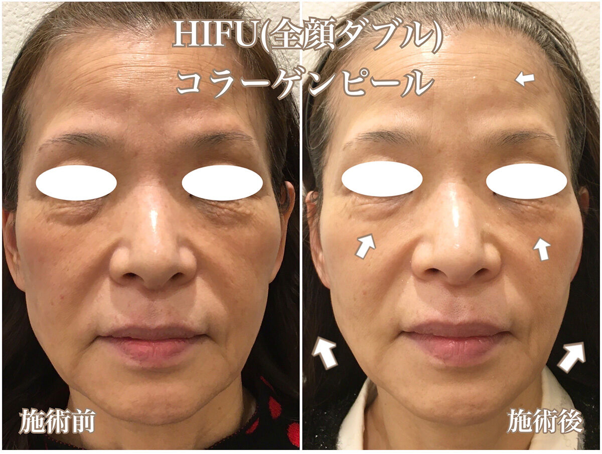 No.1597の症例写真